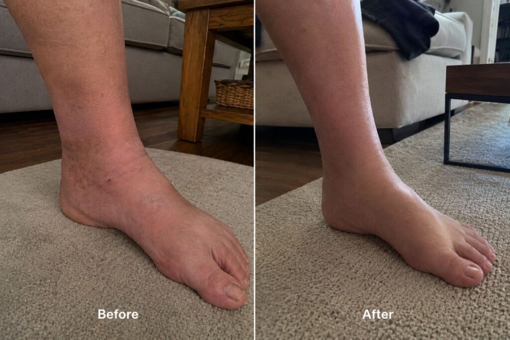 Lymph Tonic review