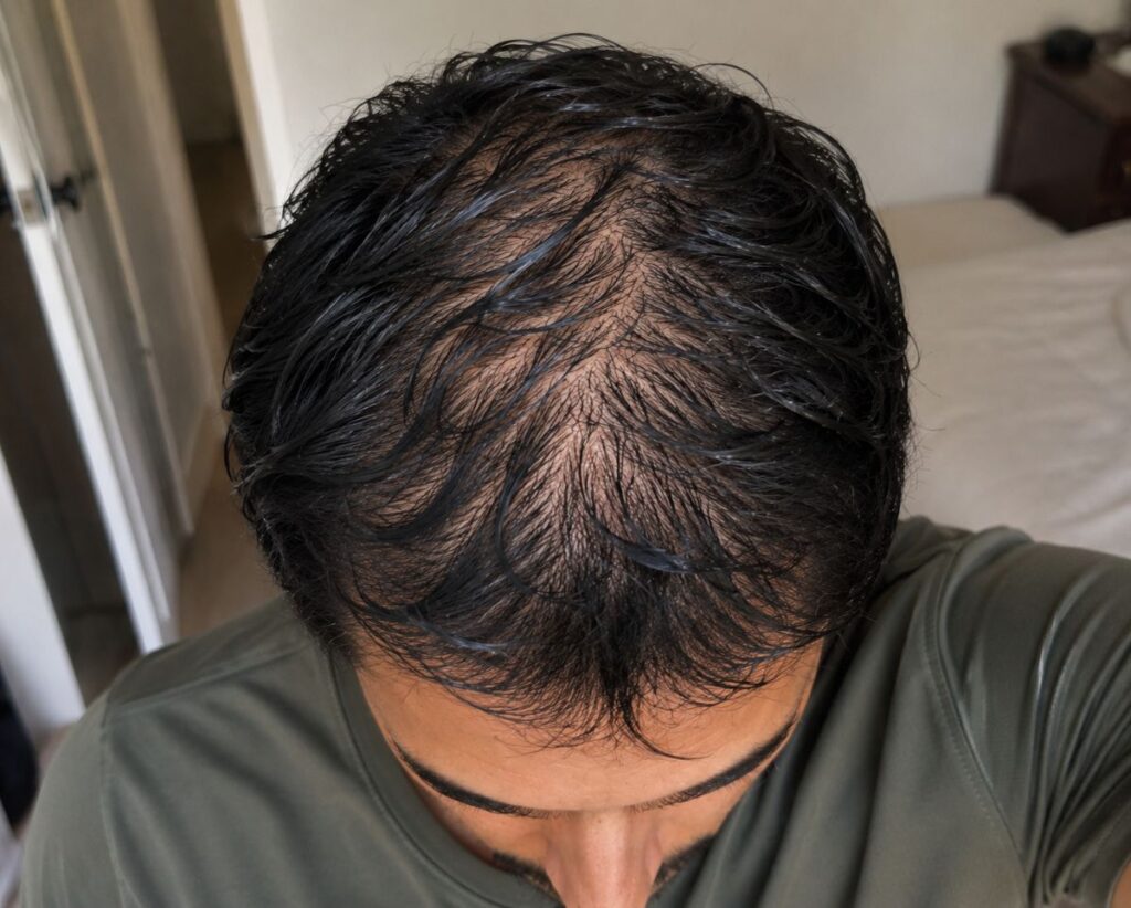 hair vigor vitalit review