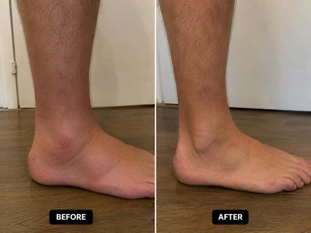 Kinzeno Joint Pain Massage Gel review