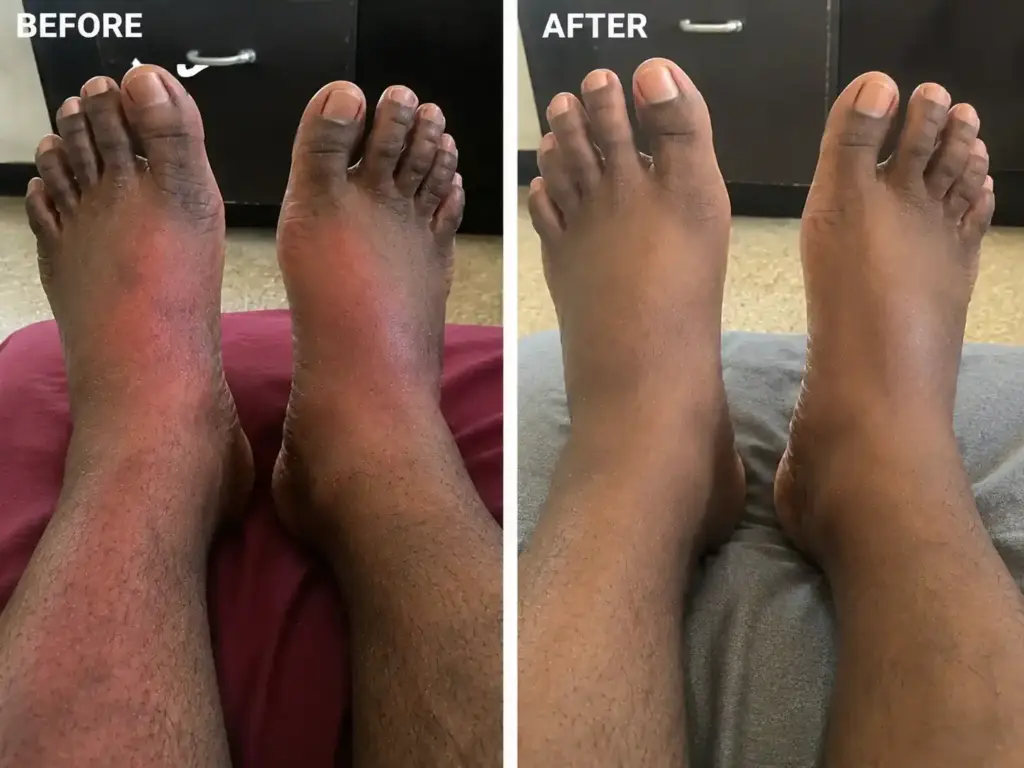NervoLyn before and after 8 week supplement trial comparison