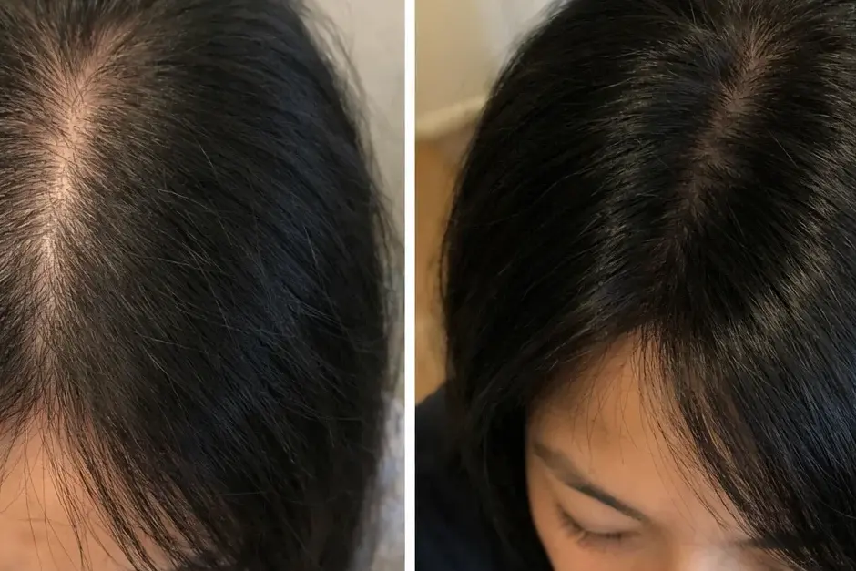akemi hair glow review