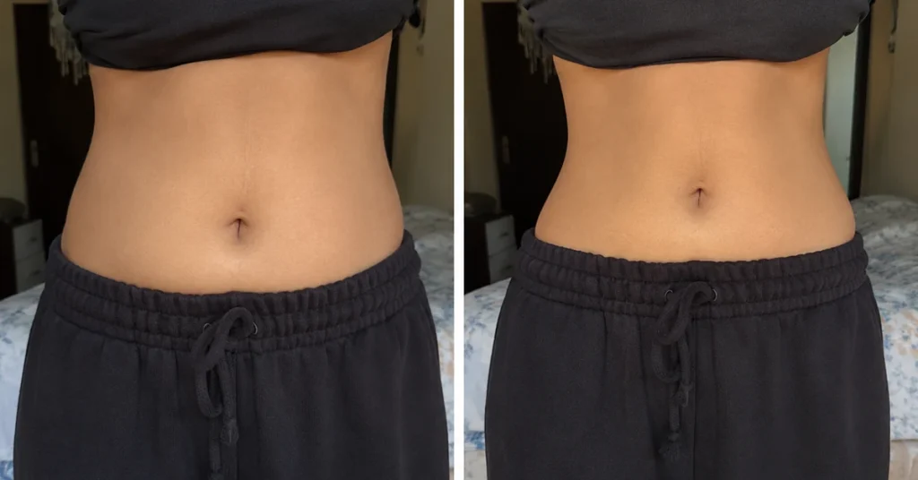 nuvoburn before after