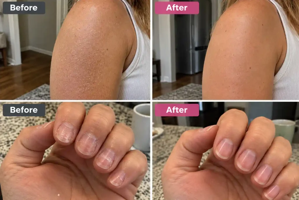 biotrust ageless muti collagen supplement before and after