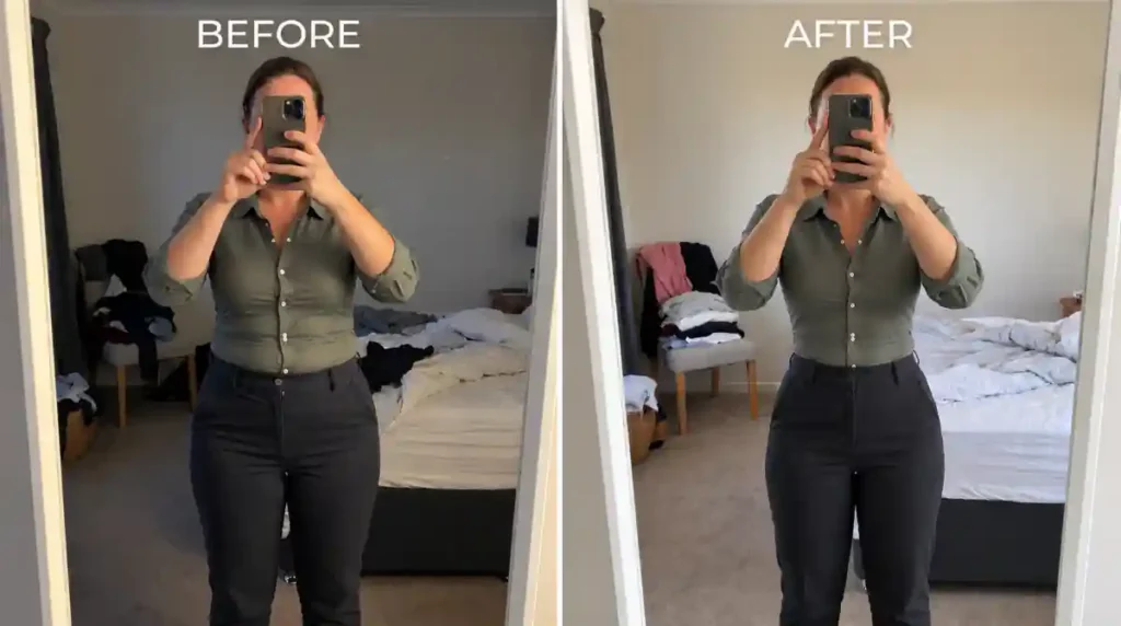 LipoMeltX before and after