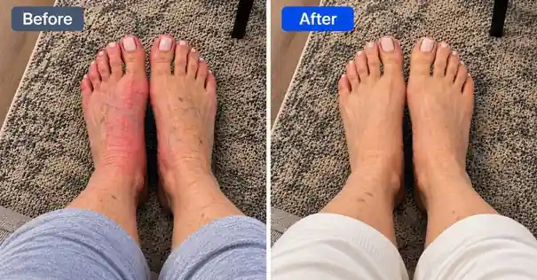 Neuralisse advanced support formula before and after